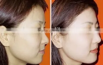 Safe painless 6 in 1 elinght rf ipl skin rejuvenation hair removal machine