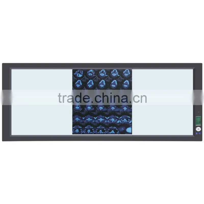 led x ray medical view box