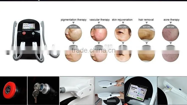 Hottest portable ipl rf shr opt two handle