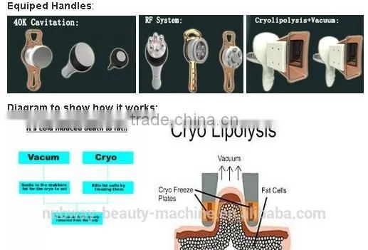 4 Heads Cryolipolysis Cool Shaping Weight Loss Cryotherapy Machine Whole Body