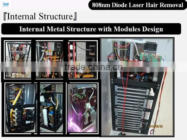 DLP7 808 diode Laser hair removal machine diode POP- DL7 808nm diode laser machine for POPIPL