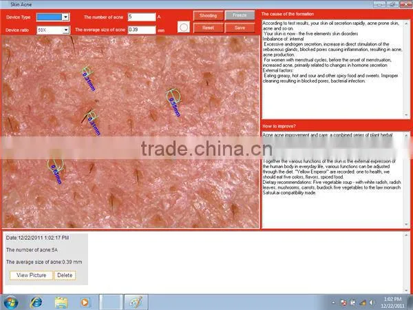 Salon and Home Skin Analyser 3D Facial Skin Analyzer Machine