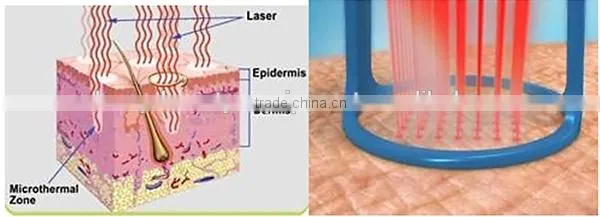 High quality competitive price co2 laser tube 400w