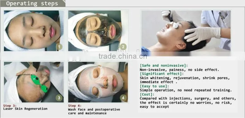 Cheap portable laser machine part balck dool for pigment removal