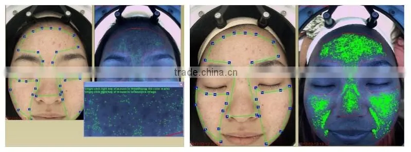 2016 popular portable magic mirror skin analyzer skin analysis machine
