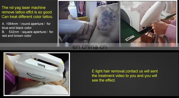 Hot selling! e light laser hair removal cost/opt system cold ipl laser machine price