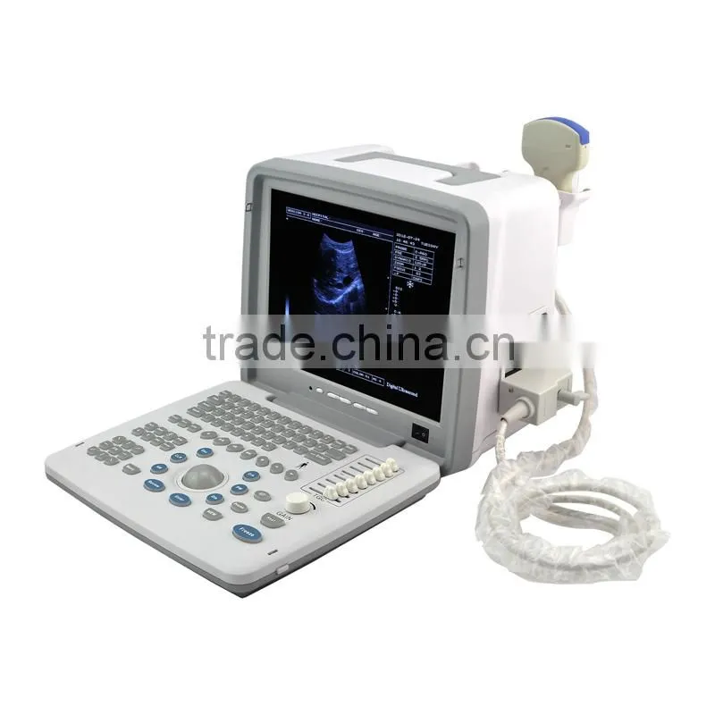 CE approved Laptop/Portable Ultrasound Scanner with 3.5Mhz multi-frequency convex probe