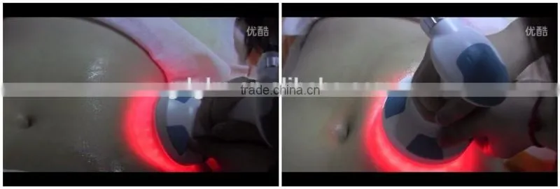 Laser Cavitation RF Vacuum Slimming Machine/B-015A