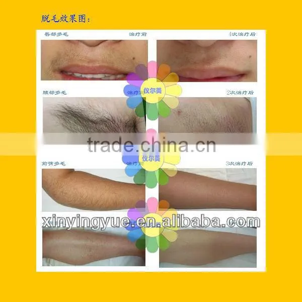 Cheap newest style mini ipl for home use