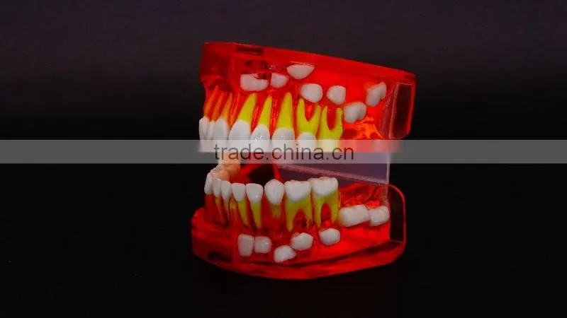 Bicolor Deciduous Teeth Development Model 1Teaching Demonstration Models