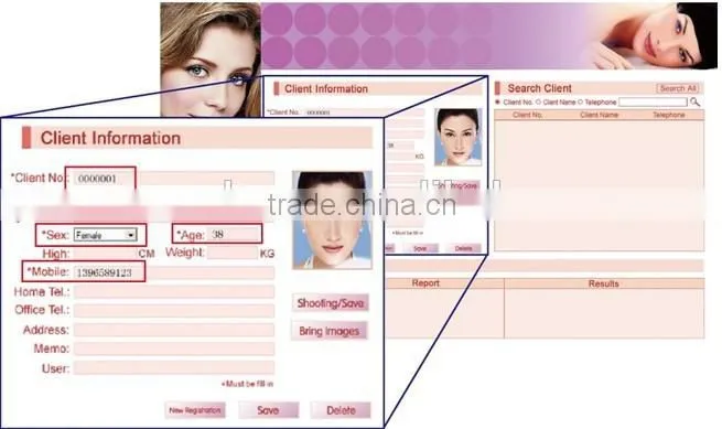 Skin Analyzer Type Portable Digital Skin analyzer