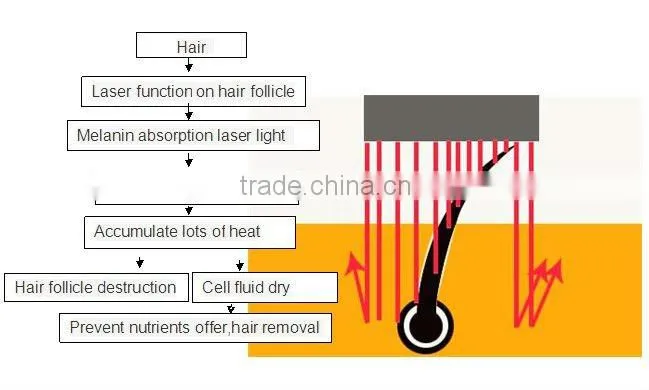 yag laser therapy nano hair removal P001