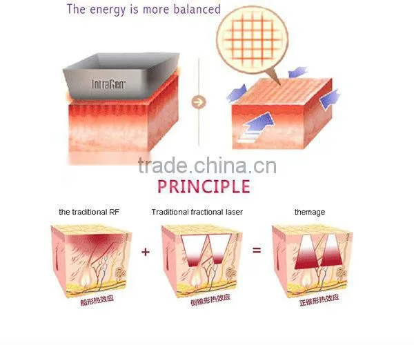 fractional rf lift