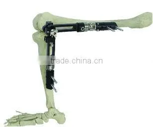 Knee Braces Bone Fracture External Fixation