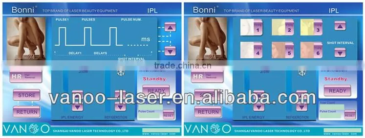 Portable Vein Removal double chin removal machine