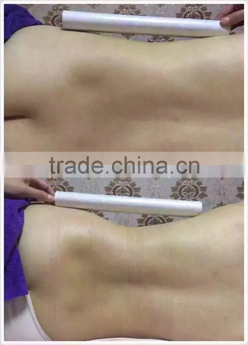 focused ultrasound HIFU body immediate slimming fat burn weight loss 2016 professional beauty salon /spa use machine