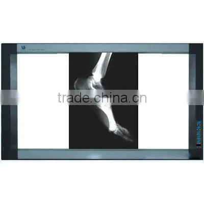 high quality low price of paper film of size A3.A4 for color Doppler ultrasound machine