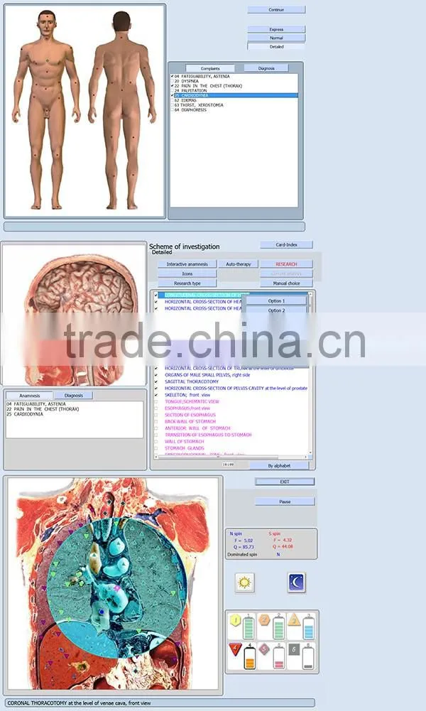 Quantum Health Analyzer Auto Full Body Health Analyzer 9D Full Body Analyzer