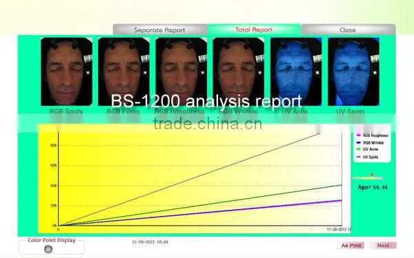 Newest 3D magic mirror visia skin analysis machine