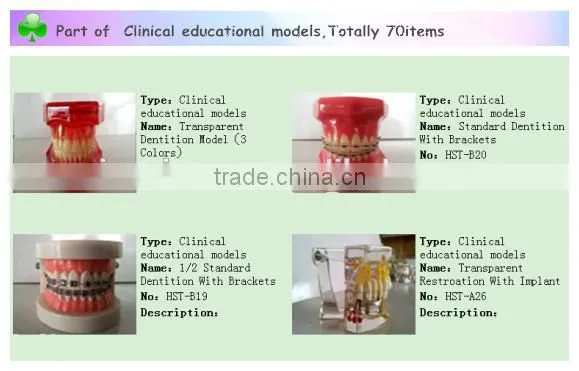 Root Canal Filling Model dental model