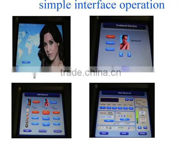 ipl wrinkle remover freckle removing machine better than cream HS-300E by shanghai med apolo medical technology