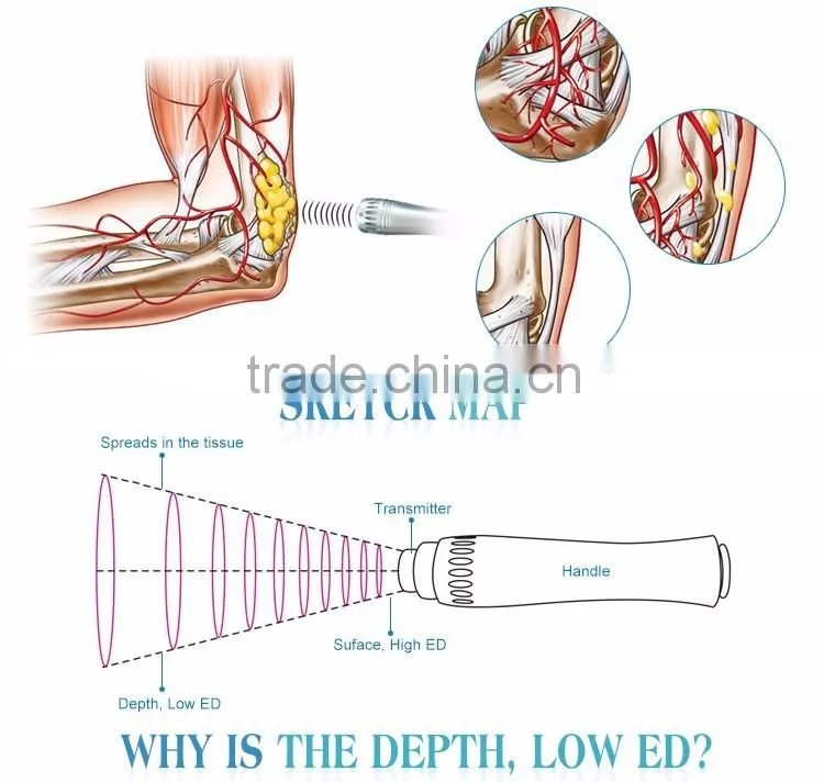 Free Side Effect Shock Wave treatment for slimming and Cellulite shockwave therapy