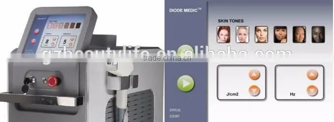 Newest!!! hot sale 808nm laser beauty device alexandrite hair removal laser