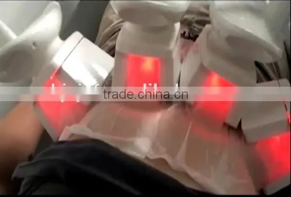 Freezefat anti-freezing membrane / Cryo slimming freeze membrane