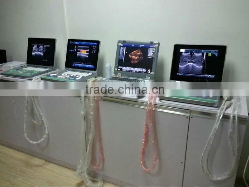 MSLPU25A HOT SALES Digital best Medical portable china portable ultrasound machine price
