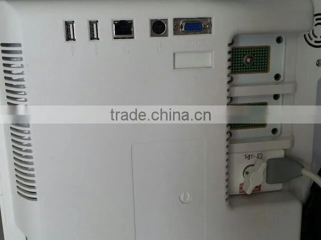 Full Digital Medical Ultrasound Scanner With Ce Marked