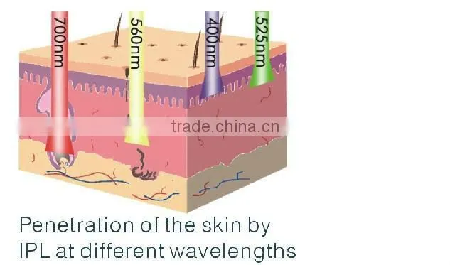 ipl rf nd yag laser hair removal machine/elight with ce/home use ipl