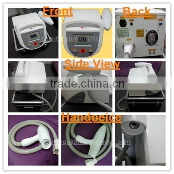 laser q switch 1064 nd yag 532 ktp tattoo removal