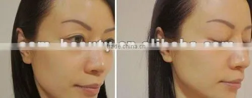 Alibaba golden suppiler provide Skin care galvanic mini facial massage , facial product-JTLH-1520