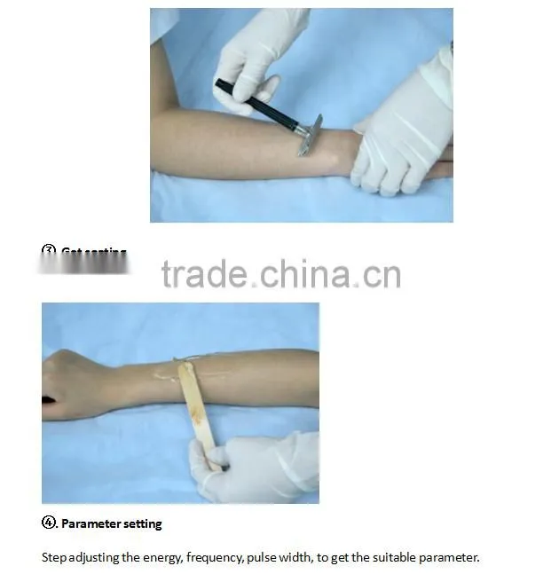 Newest Design Laser Hair Removal Machine For Dark Skin