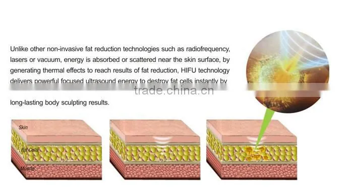 LS08-laura trending hot beauty products body slimming hifu ultrashape liposonix machine