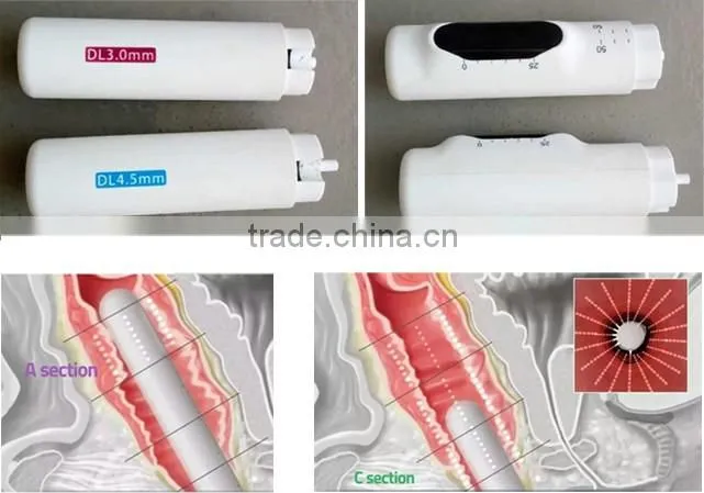 High quality hifu vaginal tightening machine
