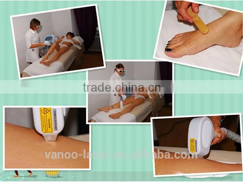 dark skin painless hair removal Shanghai Vanoo Laser