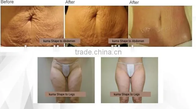 Alibaba salon equipment far infrared slimming suit for distrubutor