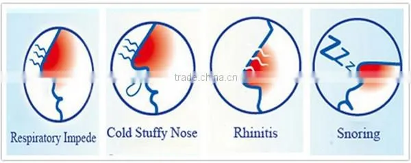 customized nasal strips oem snoring