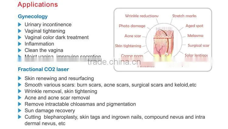 Professional 2017 newest 1-100ms pulse duration 30w fractional co2 laser treatment for acne scars