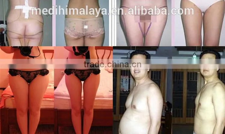 cellulite ultrasonic slimming effective slimline slimming machines