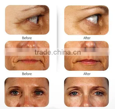 High-level Handheld Electric Facial Cleanser