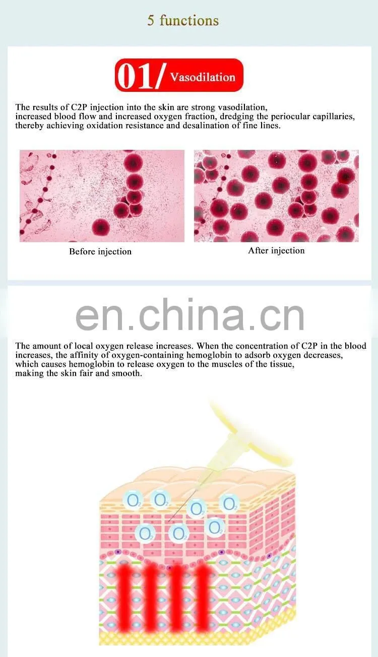 Eye wrinkles Removal Health Care Cdt Carboxytherapy Pen /CDT Beauty Equipment carboxy therapy machine /co2 carboxy therapy