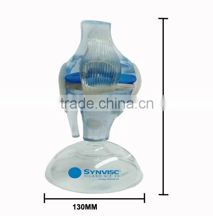 V-AM036 Plastic Human Knee Anatomic Model