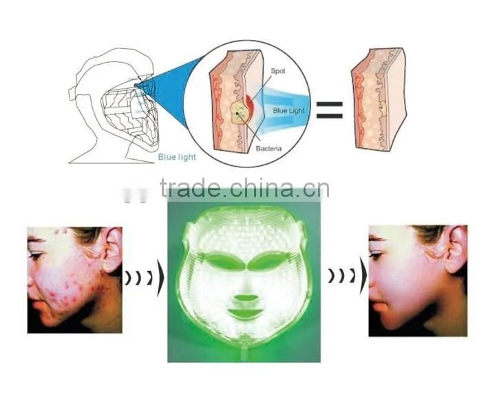 pdt led mask photon dynamic treatment skin care mask anti-inflammation