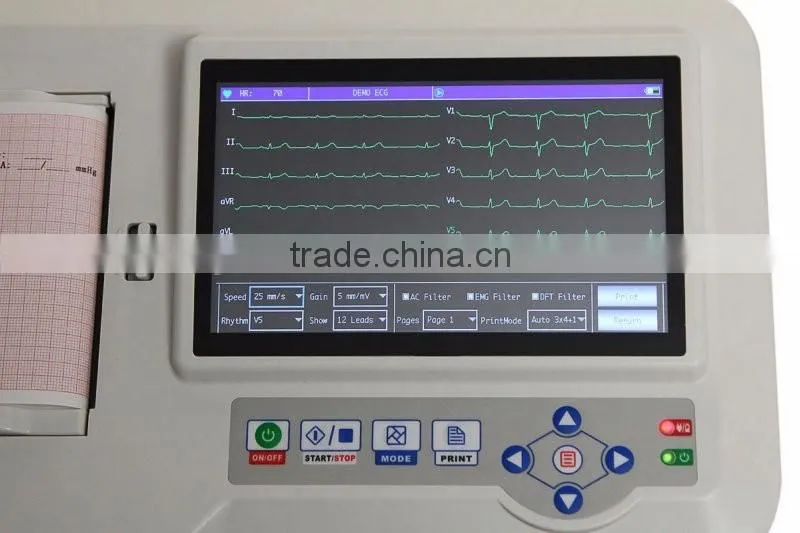 CE &ISO13485 OEM design Standard 12 leads Touch Screen Digital 6-channel Electrocardiograph