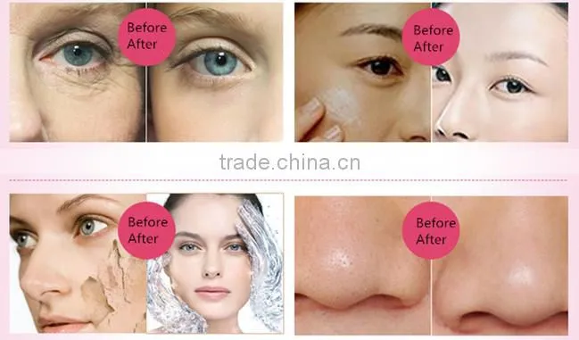 Gree Well offer multi-function handheld mini facial steamer Ion facial steamer