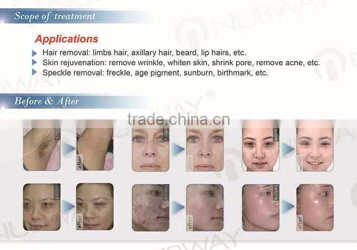 ipl skin rejuvenation shr ipl laser hair removal machine ipl shr e-light