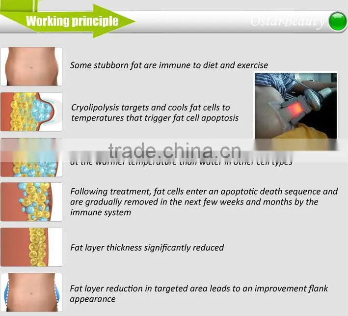 Cryolipolysis machine ultrasonic vacuum liposuction