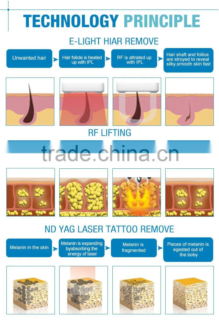 LINGMEI SHR laser IPL hair removal/ fast hair removal
